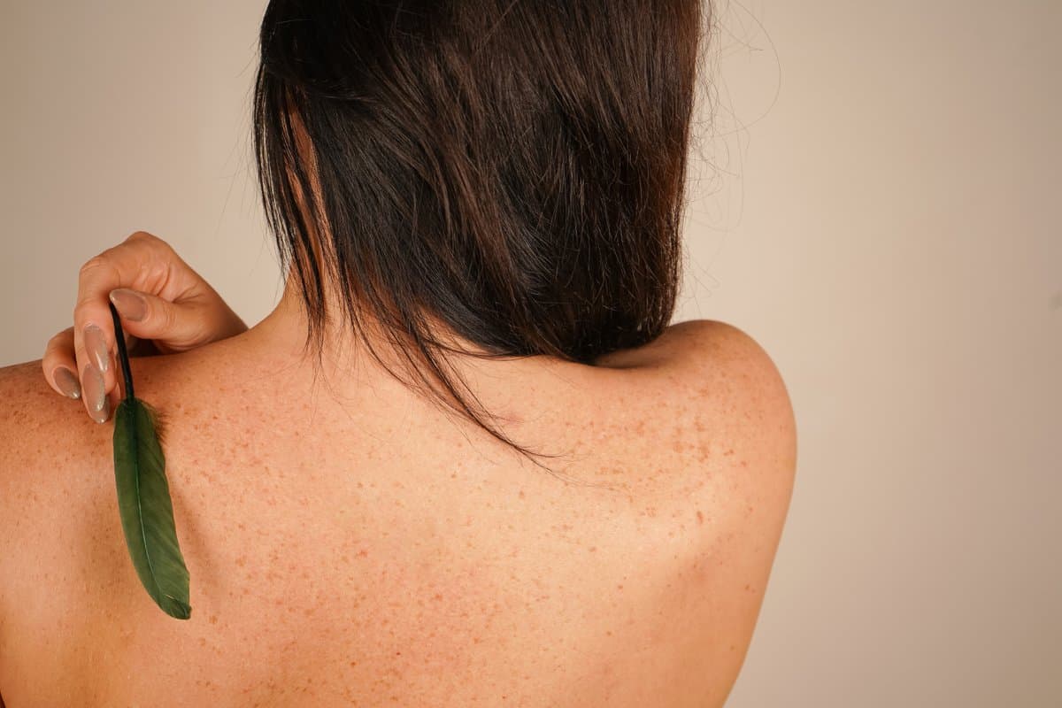 Pangangati ng Anit? 10 Dahilan Kung Bakit Hindi Tumitigil ang Pangangati ng Iyong Ulo