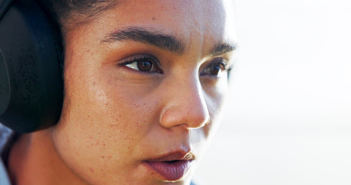 Madilim na Mantsa at Hyperpigmentation: Maagang Palatandaan at Pag-iwas