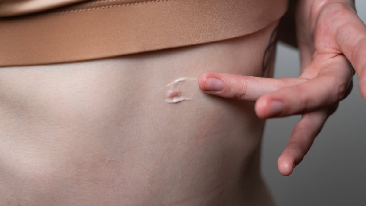 Pagkawala ng Buhok sa mga Kababaihan: 12 Sanhi na Karamihan sa mga Tao ay Hindi Alam