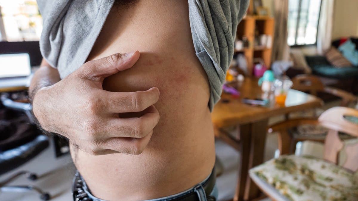 Nawawalang Buhok sa Itaas ng Ulo? Ano ang Talagang Sanhi Nito