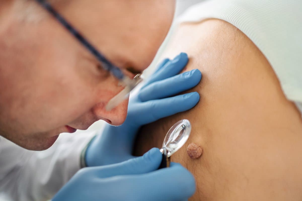 Appearance and Symptoms