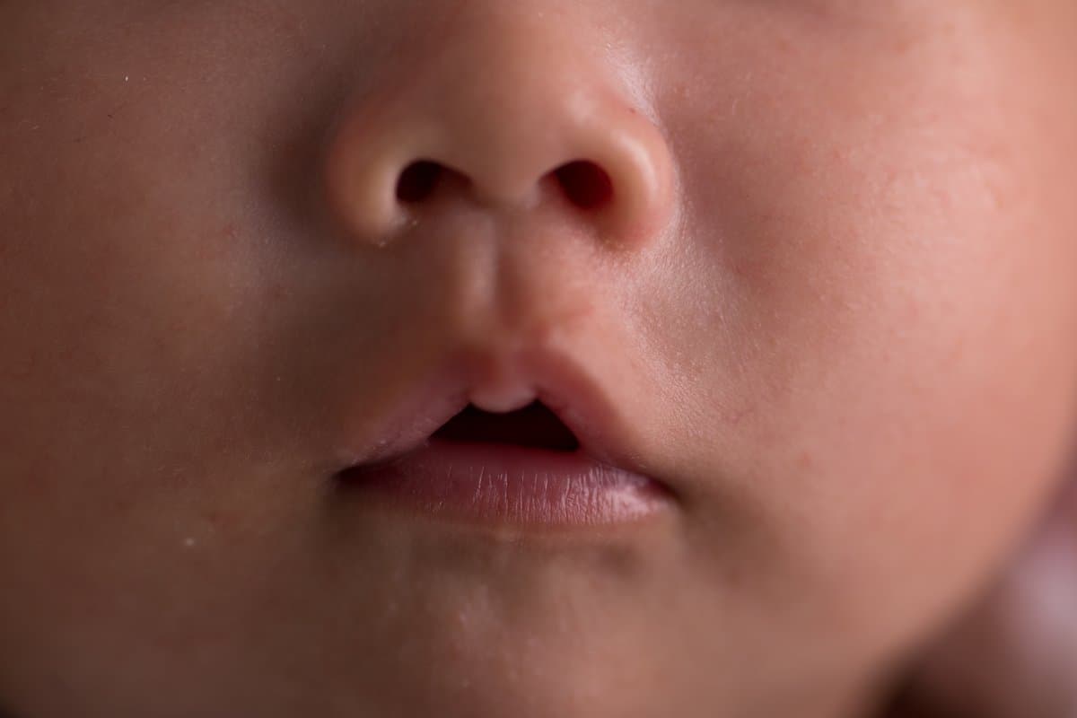 Ano ang Tunay na Kahulugan ng Malalaking Pores (At Paano Ito Ma-minimize)