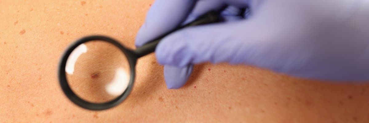 The Risk of Invasion