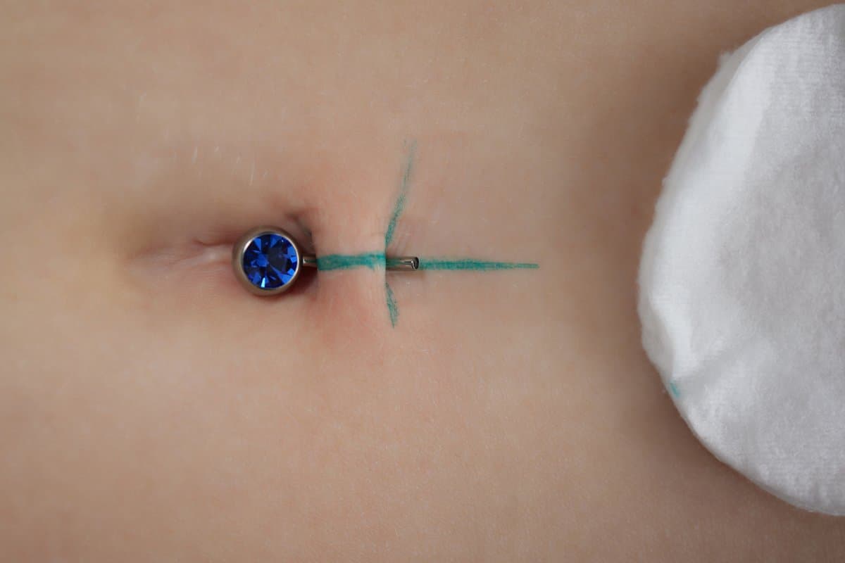 Treatment Approaches