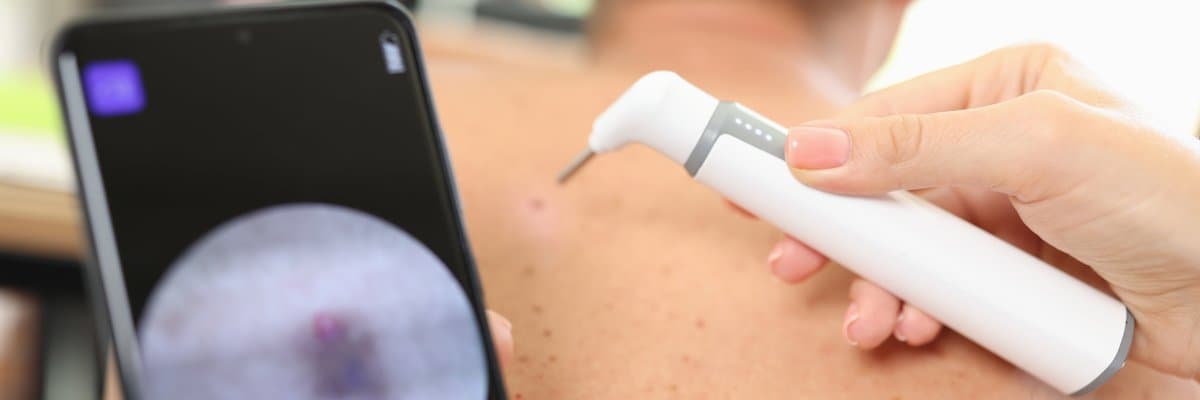 Prognosis and the Importance of Early Detection