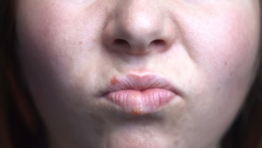Skin Texture Explained: Bumps, Roughness & Uneven Tone | Skinscanner Blog