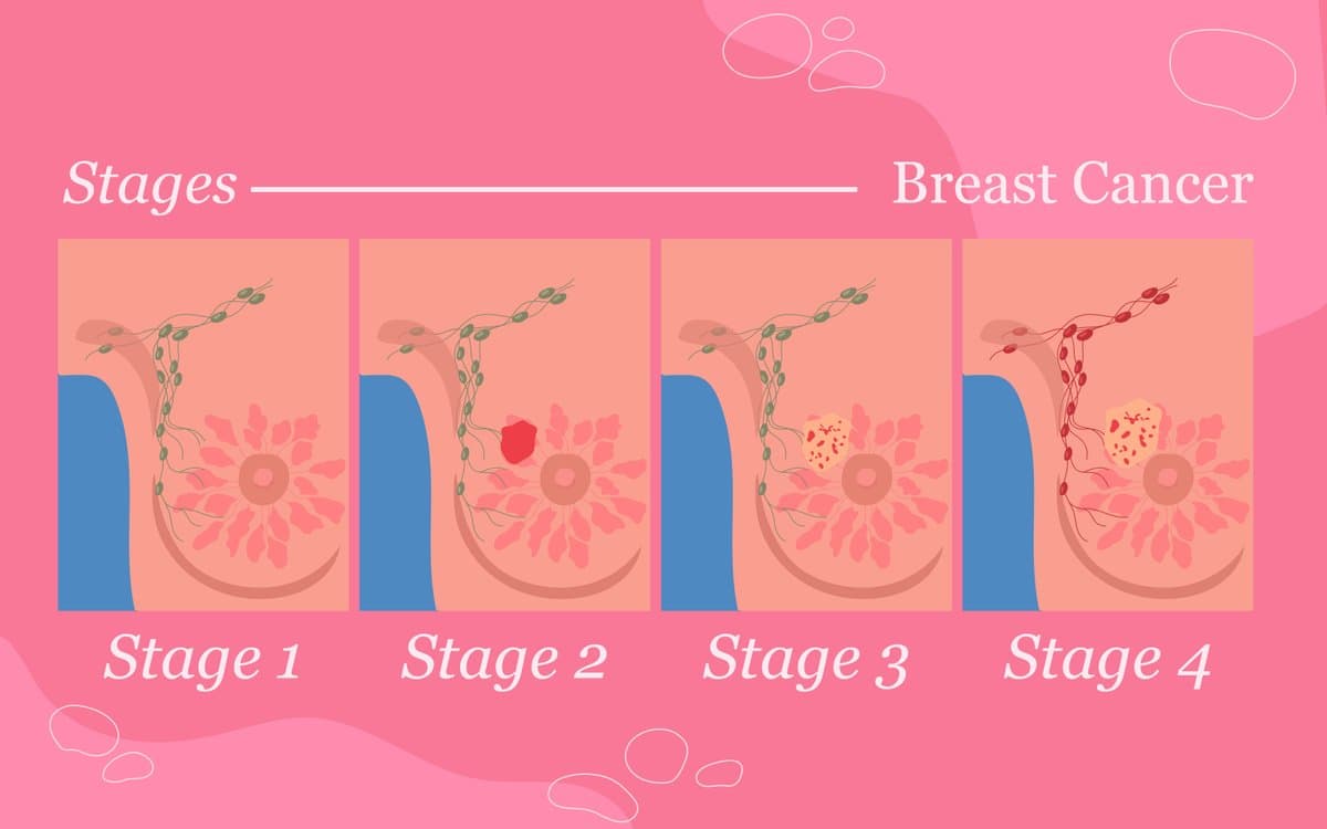 Staging and Prognosis: Why Size and Depth Matter