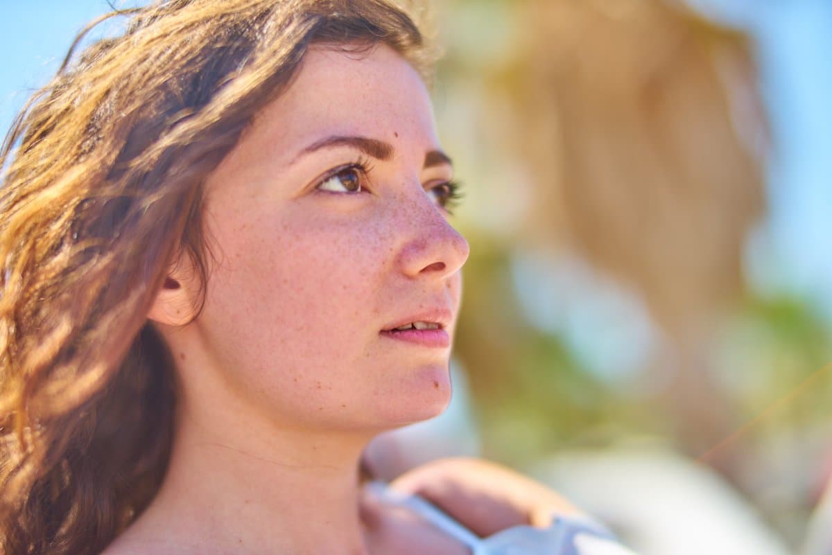 Who Gets Superficial Spreading Melanoma?