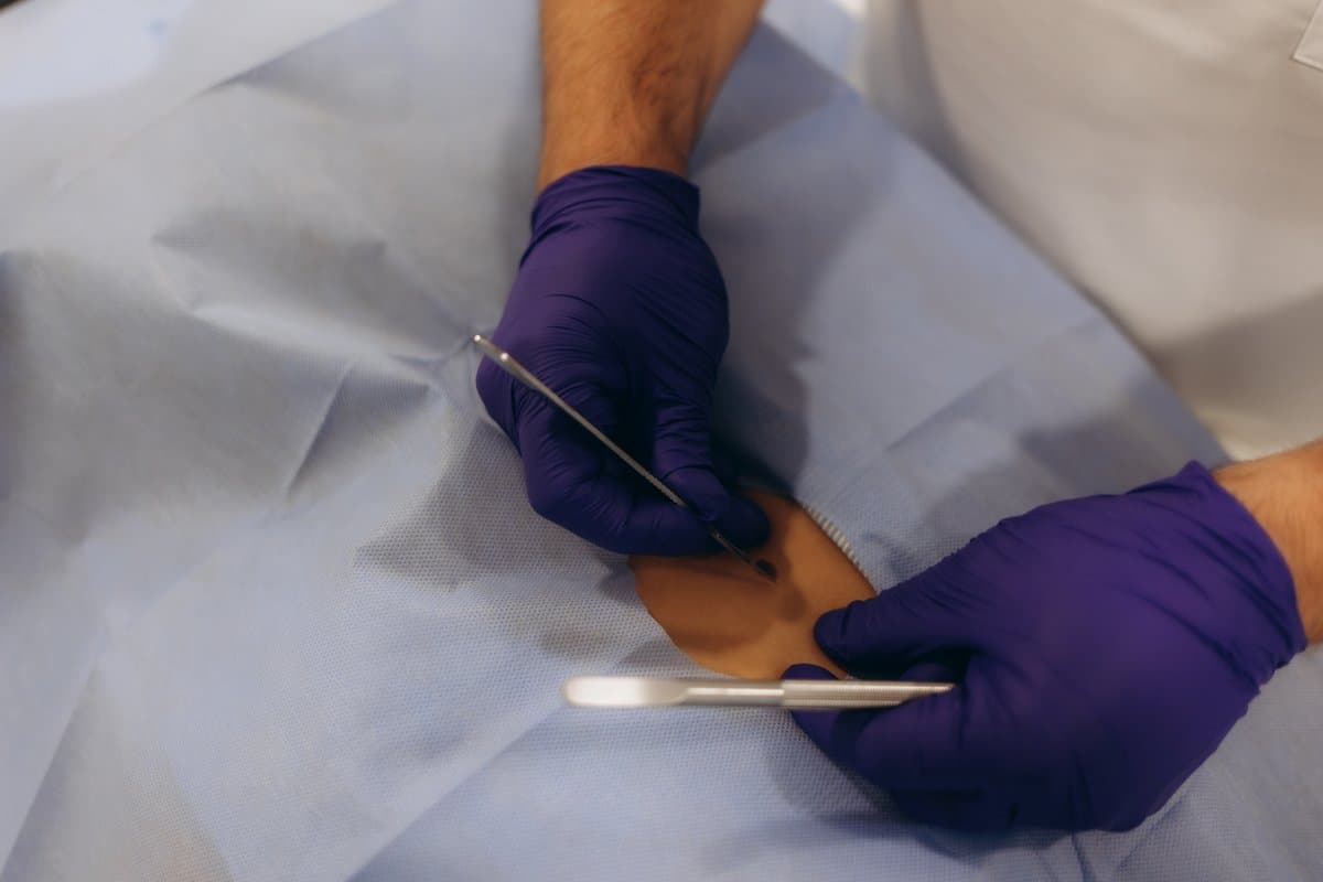 Treatment Approaches