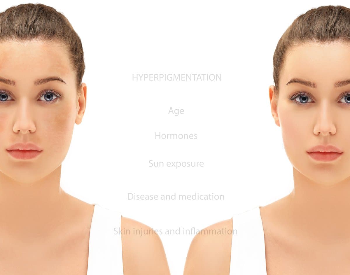 Camera Technique and Smartphone Tips