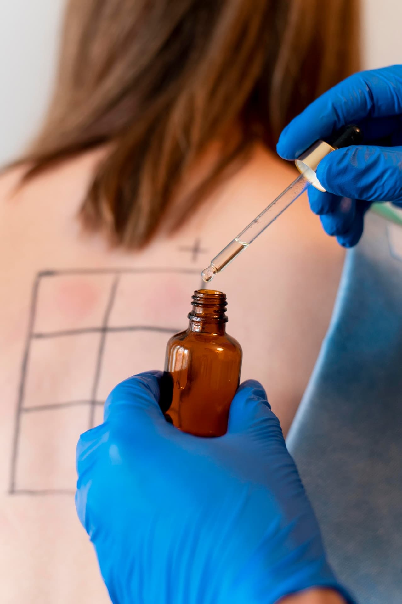 Pananaliksik sa Balat