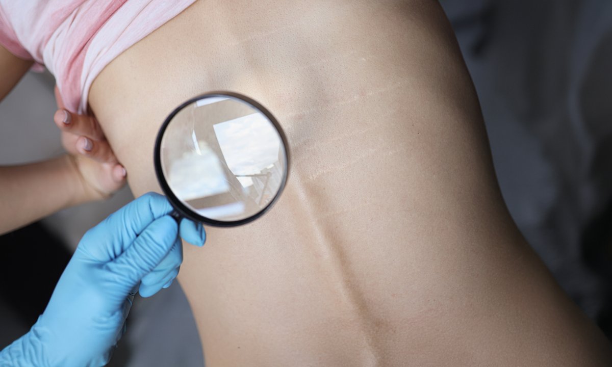 Lump Under Skin: When to Worry and When It's Harmless | Skinscanner Blog